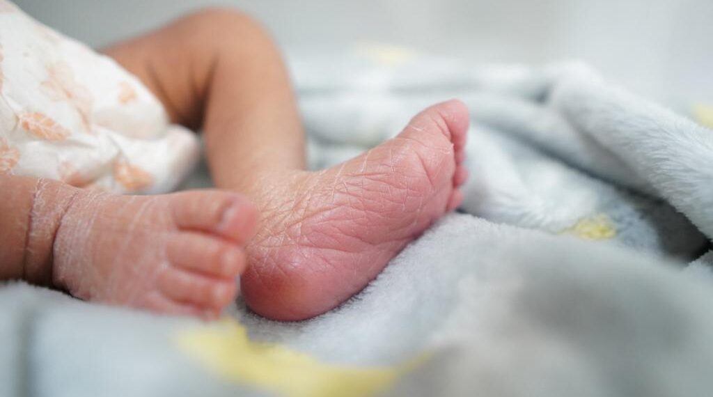 Talla baja y cuello ancho pueden ser señales del Síndrome de Turner: SSO