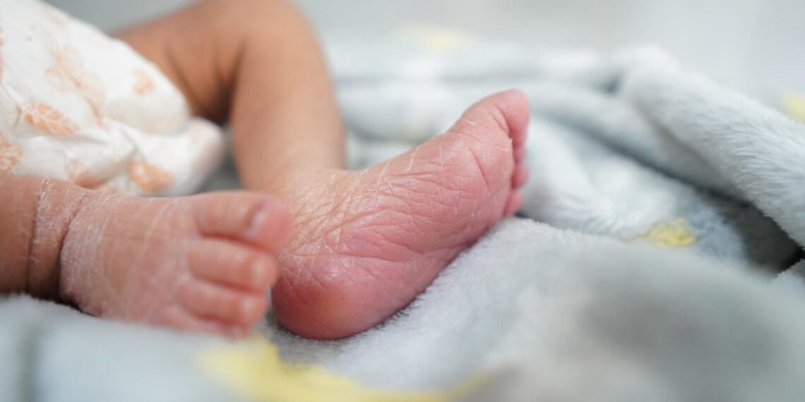 Ausencia de ácido fólico en la gestación puede causar espina bífida en recién nacidos: SSO